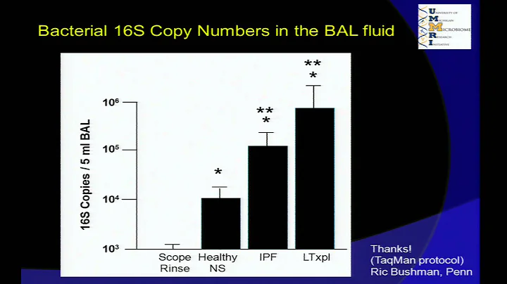 The Lung Microbiome: Challenging Old Paradigms about Microbes... - Gary Huffnagle