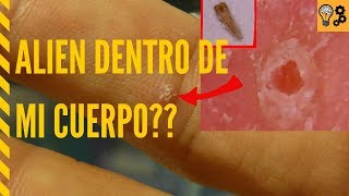 ¿Un ALIEN Invade Mi Cuerpo Y Se Alimenta De Mi? 👽 Curiosidades | El Mago 2.0 ¿Un ALIEN Invade Mi Cuerpo Y Se Alimenta De Mi? 👽 Curiosidades | El Mago 2.0
