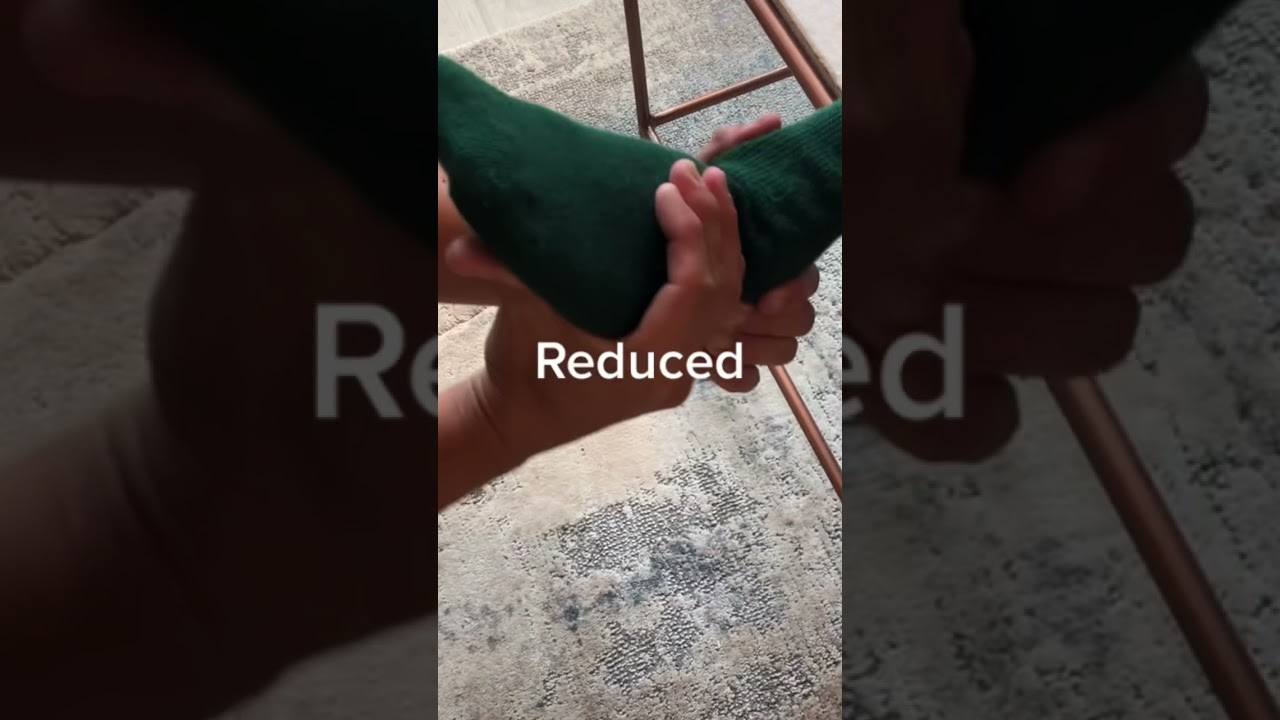 We started developing Ankle dislocation simulator!  Stay tuned!