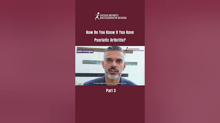 How Do You Know If You Have Psoriatic Arthritis? | PART 3 #PsoriaticArthritis #Rheumatology