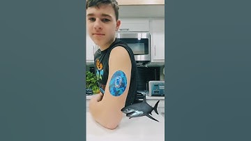 JAWESOME Shark Patch for Dexcom G6 - #expressionmed #dexcom #t1dlookslikeme #glucosemonitor #t1d