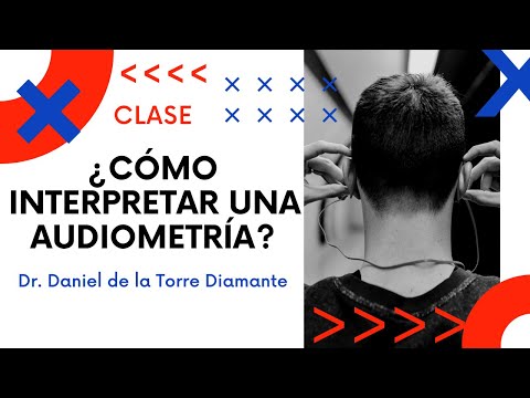 Video: Cómo leer un audiograma: 15 pasos (con imágenes)