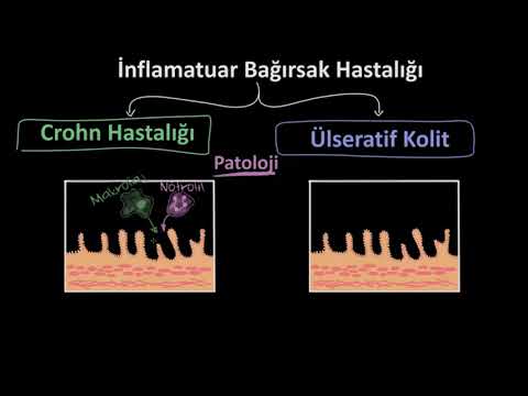 İnflamatuar Bağırsak Hastalığı Epidemiyoloji ve Patolojisi (Fen Bilimleri)(Sağlık ve Tıp)