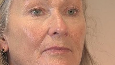 How To Conceal Wrinkles