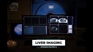 LIVER IMAGING – OPTIMIZING DWI (part 1)