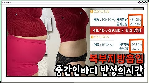 [복부지방흡입vlog]인바디 반성의시간(체성분검사)비교,경과상담|지흡후놀라운옷핏변화