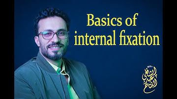 01 Basics of internal fixation: Introduction & pre operative planning
