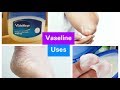 15 Uses Of Vaseline