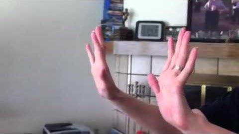 Hands Two weeks and 1 day after CCSVI Procedure