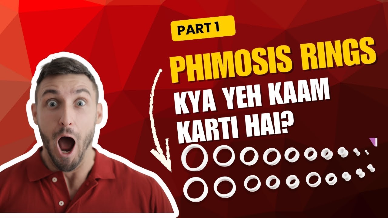 Maine Phimosis Treatment Rings Kyu Aur Kaise Khareede? | Complete Guide