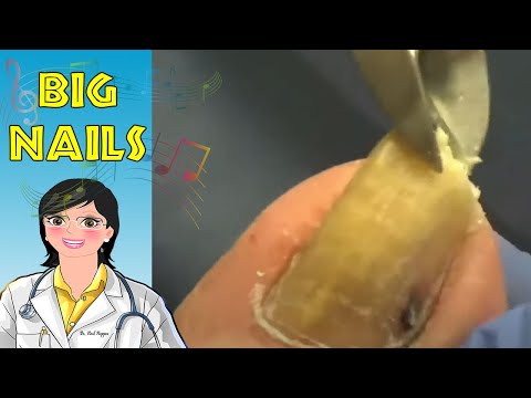 Crusty Highlights and Music 4