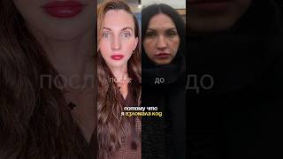ЧТО Я СДЕЛАЛА С НОСОГУБКОЙ? Читай описание ⤵️ #носогубка #носогубныескладки #филлеры #косметология