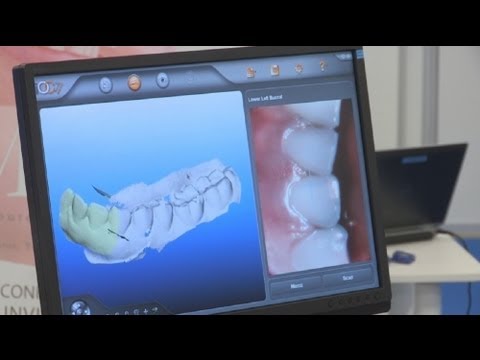 Βίντεο: Είναι οδοντιατρική λέξη;
