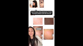 Pore Care Review
Want smaller-looking pores? this study shows exactly what helps.
https://www.youtube.com/watch?v=2S_bER4tAK8 Pore Care Review