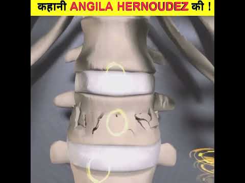 कहानी ANGILA HERNOUDEZ की !  #amazingfacts #new #trendingvideo STORY VIDEO / COMEDY VIDEO / FACTS