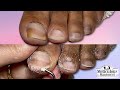 👣ASMR Pedicure RELAXING Sleep Video👣