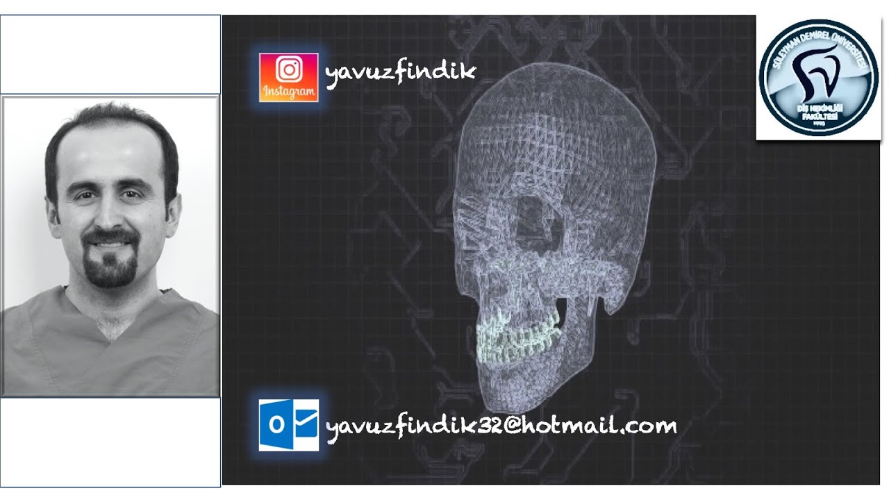 Surgery first, piezo cerrahi, çene ameliyatları, telsiz çene ameliyatı