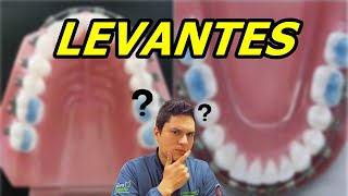 Levante De Mordida Ou Batentes Em Ortodontia Para Que Servem?