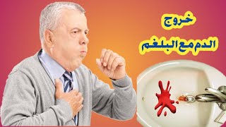 خروج الدم مع البلغم اسبابه و هل يدل على مرض خطير ؟