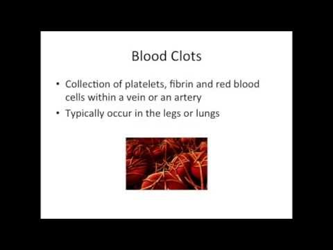 IBD School 213: Blood Clots