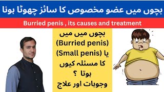 Burried - Bachon Mn Size Ka Chota Hona- Causes And Treatment-Urdu Hindi- Home Tips