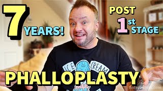 Life After Phalloplasty Is Incredible and Normal At The Same Time | 7 Years Post 1st Stage