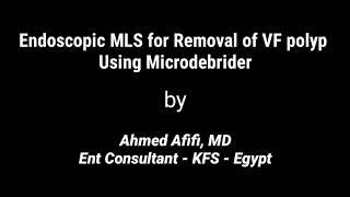 Endoscopic microlaryngeal surgery to remove vocal fold polyp using microdebrider. Afifi, MD