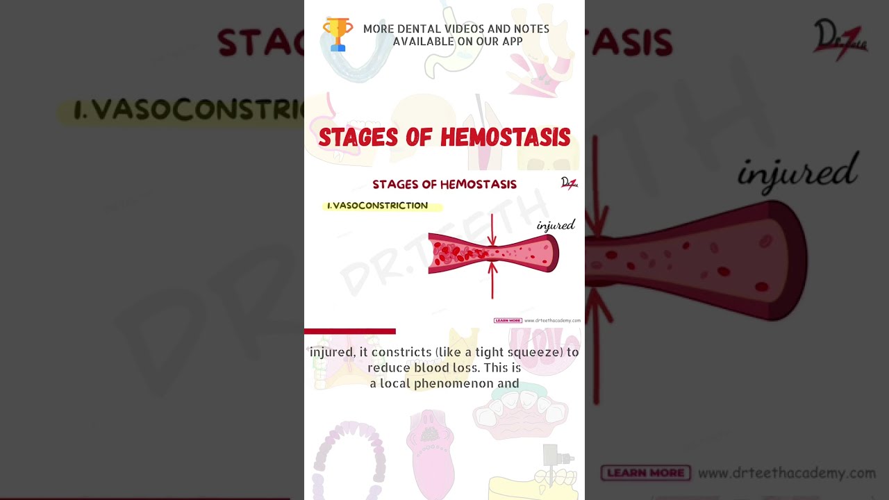 Stages Of Hemostasis