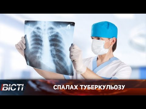 На Прикарпатті зросла кількість хворих на туберкульоз