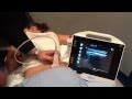 Ultrasound Guided SI Joint Injection