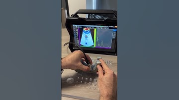 How to apply Ultrasonic Phased Array Inspection on radius casting surface? #ndt #PAUT #ndtteknik #ut