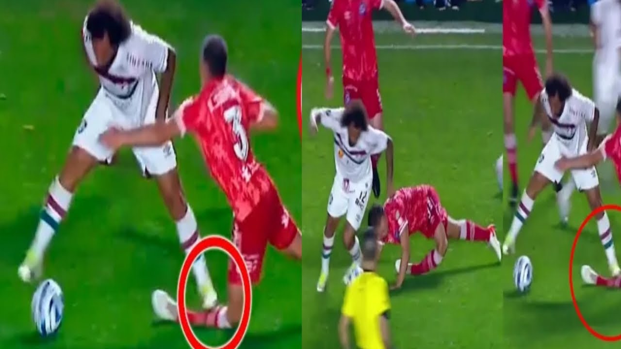 marcelo broke luciano Sanchez's leg😱 #football injury #yesterday ...