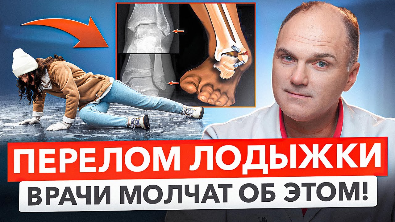Перелом лодыжки: когда нужен гипс, а когда — операция? | Травматолог Банецкий Максим