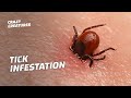 Warning the most horrific tick infestations