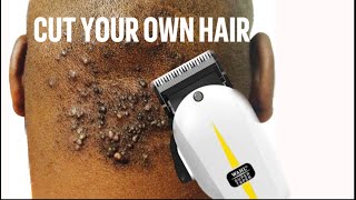 HOW I CUT MY HAIR WITH ACNE KELOIDALIS NUCHAE