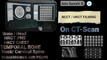 NCCT & HRCT Filming On CT-SCAN | Part-1 | By Anis Qureshi