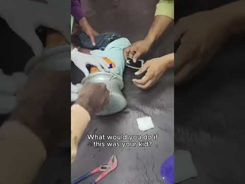 This Playtime Accident Ended In The ER...