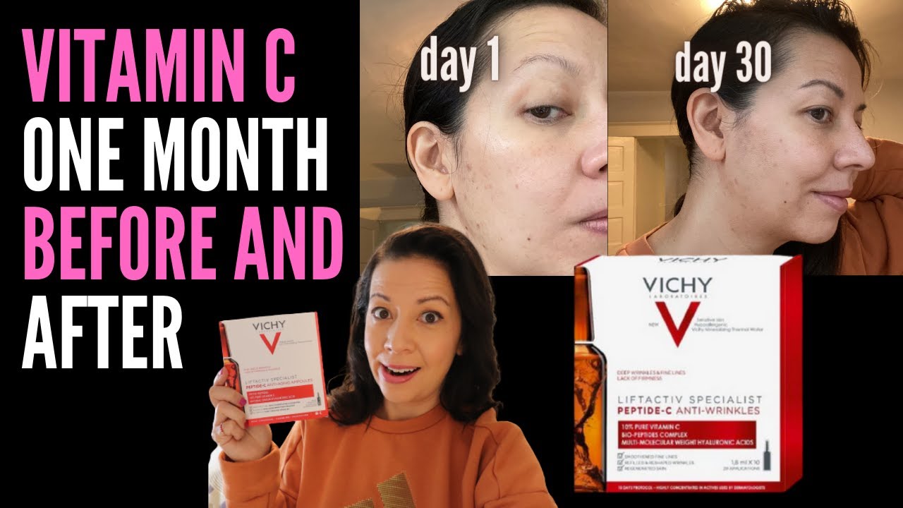 One Month Test Is Vichy Liftactive Ampoules The Best Vitamin C And A Dupe For Skinceuticals Youtube