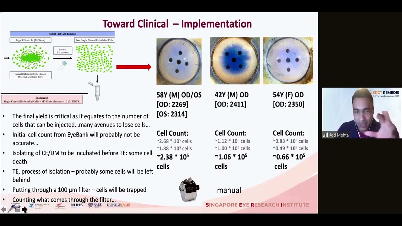 Keynote Address Non Cultured Endothelial cell Therapy Dr Jodbir