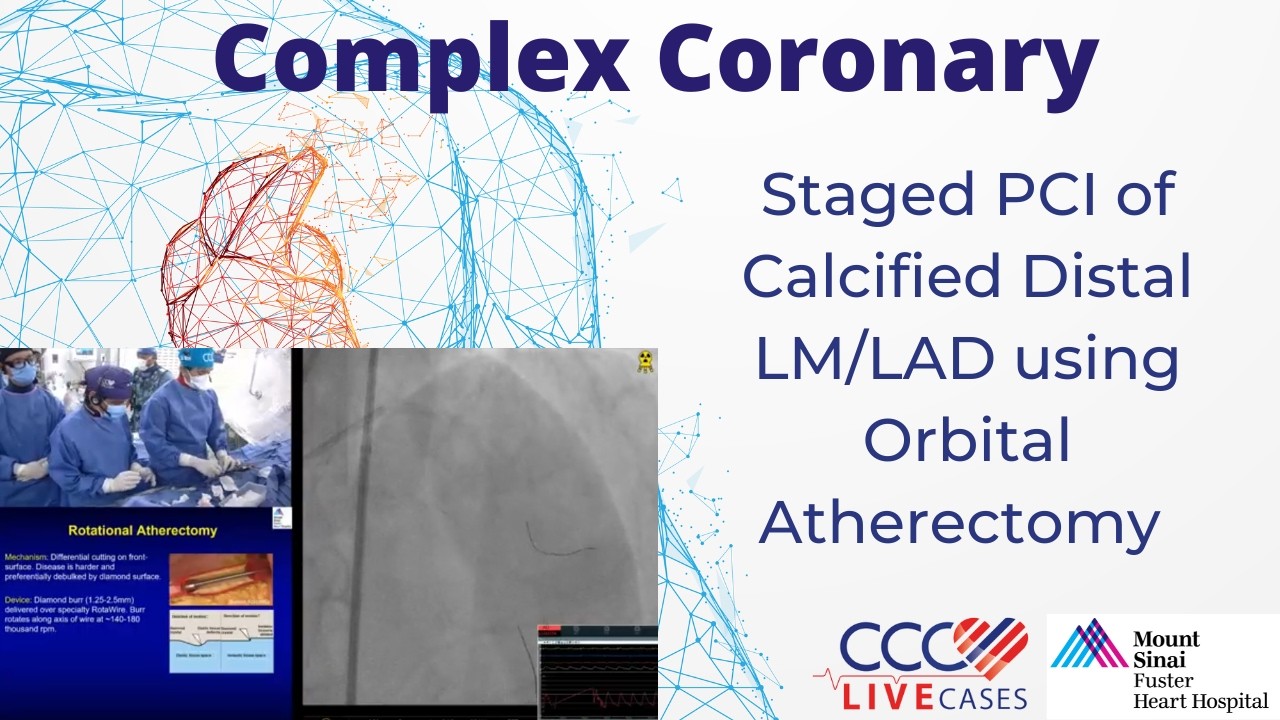 Orbital Atherectomy for Calcified Coronary Lesions