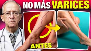 Thumbnail image for 🦵 Si ves venas muy marcadas en las piernas, esto es lo que está pasando - Oswaldo Restrepo RSC