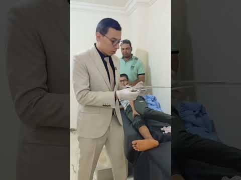 رفع الاسلاك بعد التئام الكسر     