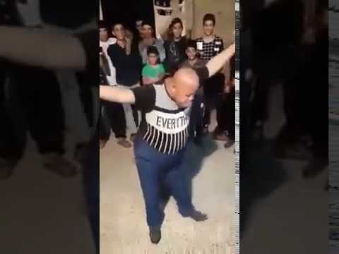 مصاب متلازمة داون احلى رقصة