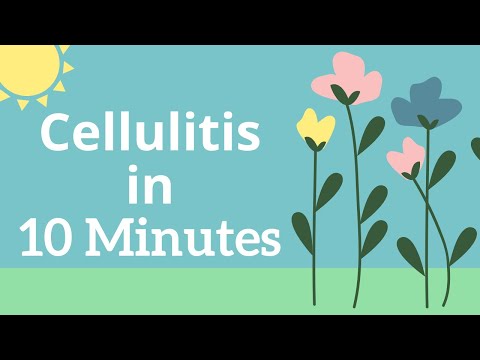 10 मिनट में सेल्युलाइटिस- नर्सिंग