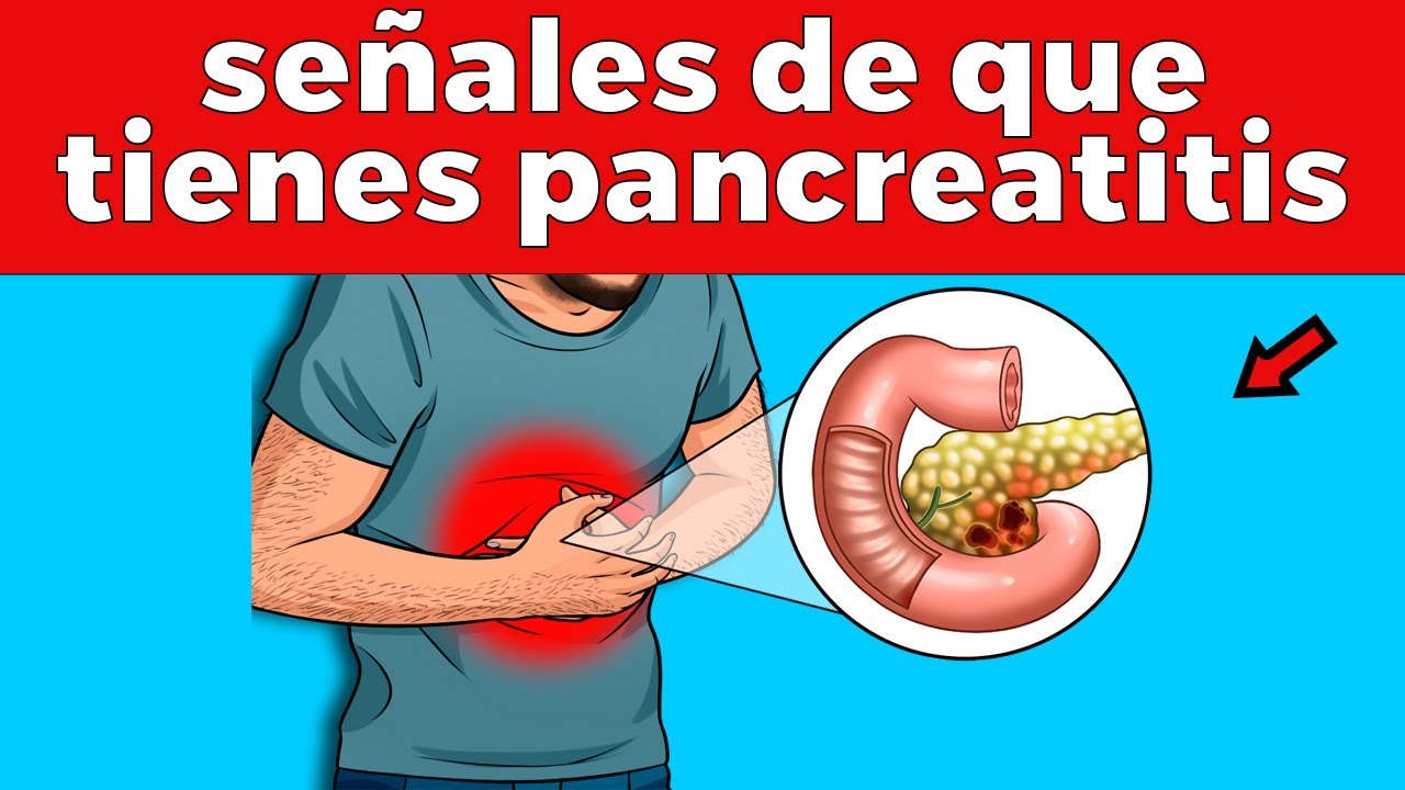 Se puede curar la pancreatitis