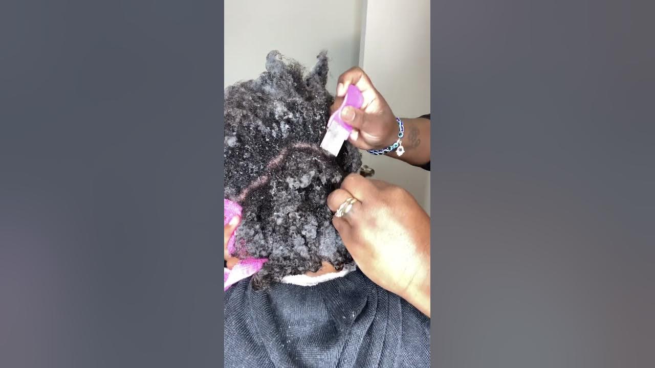How to remove buildup off your scalp YouTube