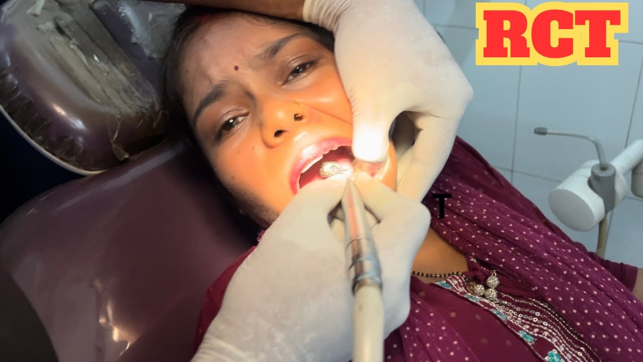 ROOT CANAL Treatment Karwana Pada RCT #couple#vlog#marriage 