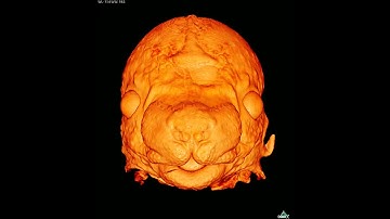 3D animation of an embryonic mouse head