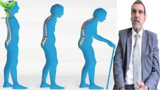 علاج هشاشة العظام بالاعشاب والتغذية  Osteoporosis Dr mohamed al fayed  محمد الفايد  fayed