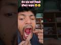 डॉक्टर साहब मेरा दात ऊपर वाला खड़ा थानीचे वाला क्यों निकाल दिए 😜😂🤦 #comedy #funny #love #fun #shorts